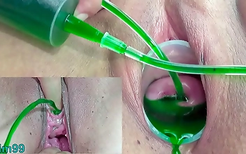 Japanese Lesbians Cumming Hard With Cervix And Pee Hole Inflation